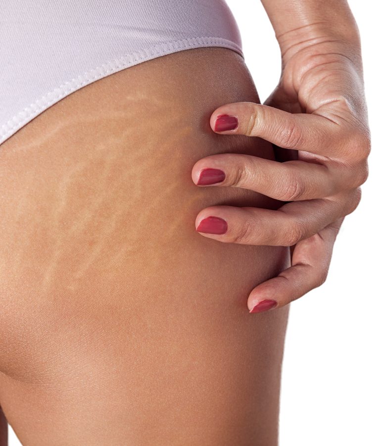 How To Get The Perfect Camouflage Tattoo For Your Skin Tone