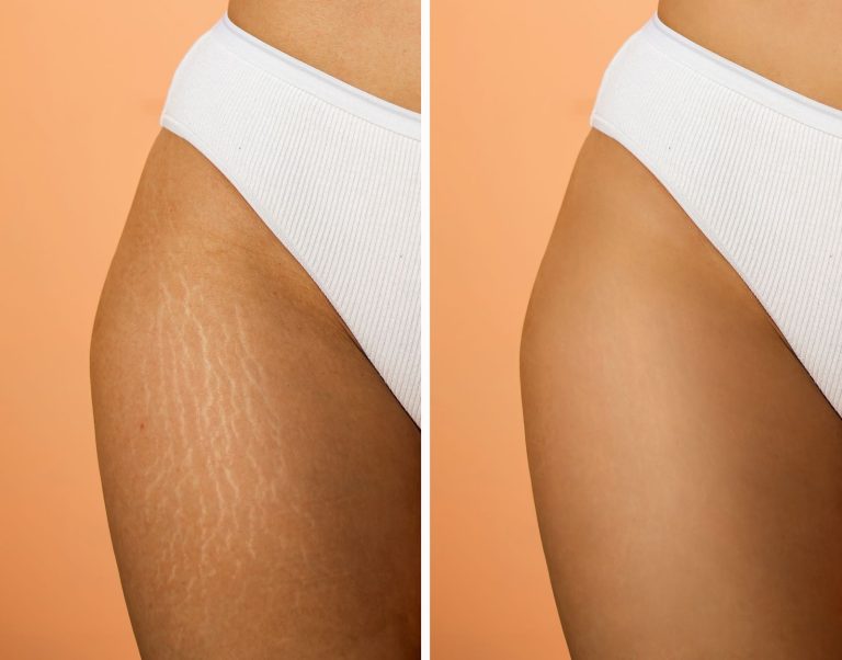 An Ultimate Guide To Camouflage Tattoo