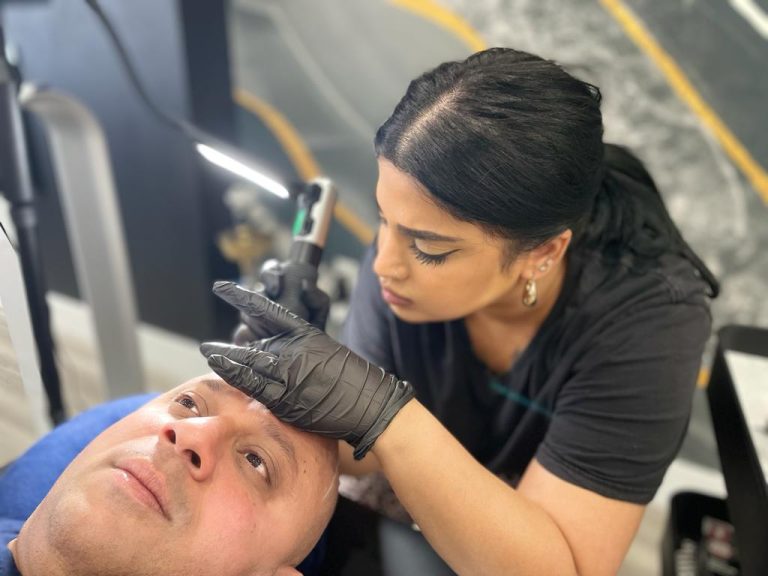 What Happens Before, During  After Scalp Micropigmentation?