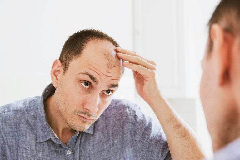 Say Goodbye to Baldness – How Scalp Micropigmentation is Changing Lives!